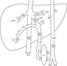 Image result for Delayed Transition from Fetal Circulation