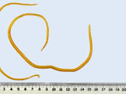 Ascaridíase (lombriga) | Sintomas, fotos e tratamento