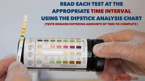 Urinalysis Osce Guide Geeky Medics