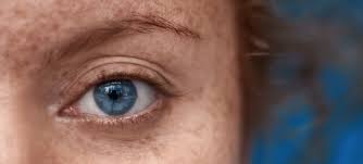 But hearing the words can still be scary. Q A Skin Cancer Of The Eyelid Moffitt
