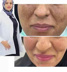 منوررررررررررررررررررررررة يا دكتورة