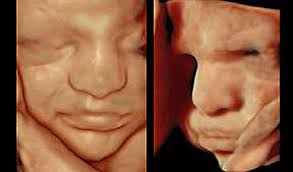 Jeden tag werden tausende neue, hochwertige bilder hinzugefügt. Wenn Der Fetus Im Ultraschall Lachelt Medmix