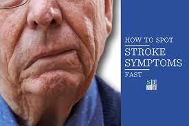 Symptoms in the fast test identify most strokes, but occasionally a stroke can cause different symptoms. Spot Stroke Symptoms Fast With These Guidelines Stmg Nashville