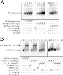 Maybe you would like to learn more about one of these? Arginine Methylation Of The Human Immunodeficiency Virus Type 1 Tat Protein By Prmt6 Negatively Affects Tat Interactions With Both Cyclin T1 And The Tat Transactivation Region Journal Of Virology