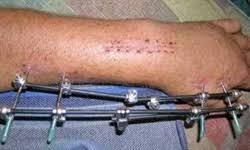 Eriskin Onkol Kiriklari