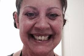 Fundraiser for Kelly Koons by Kelly Koons : Kelly Koons' Treatment Fund