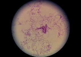 Image result for Anthrax