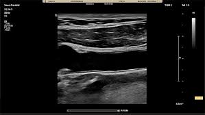 Visit any of our locations today for efficient and affordable urgent care services. Vascular Ultrasound Machine Portfolio Philips Healthcare