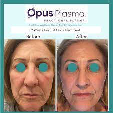 Location & hours 125 e elm st ste 260 conshohocken, pa 19428 get directions edit business info amenities and more by appointment only masks required staff wears masks accepts credit cards 9 more attributes ask the community ask a question yelp users haven’t asked any questions yet about cool river aesthetic center for skin rejuvenation. Cool River Aesthetic Center For Skin Rejuvenation Posts Facebook