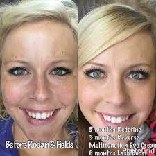 Profile for Rodan + Fields