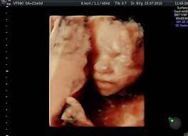 Our baby boy nicolai in 4d ultrasonic. 3d 4d Ultraschall Pranataldiaknostik