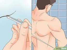 Maybe you would like to learn more about one of these? 4 Ways To Get Rid Of Pubic Lice Wikihow