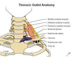 Thoracic Outlet Syndrome Tos Msk Medbullets Step 1