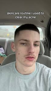 Aiden The Caring One