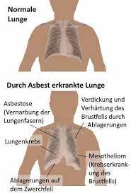 Asbest Gefahr Erkennen Heimtest Schnelltests De