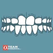 Pain in any part of your mouth a jaw that clicks twisted or crooked teeth Six Signs You May Need Braces Team Orthodontics