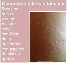 Pin On Hogar
