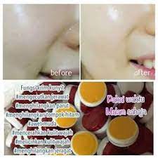 Hanat betoi geng kunyit ni. Krim Kunyit Sabun Kunyit Original Thailand Shopee Malaysia