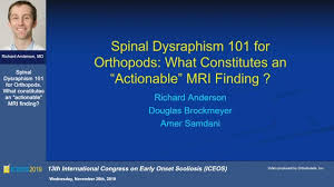 Image result for Dysraphism