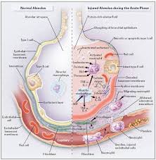 pin on respiratory