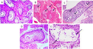 Have to throw an exception in my camel route defined in xml. Potential Pathogens In Infertile Male Dromedary Camels And Their Association With The Spermiogram And Clinical Findings Springerlink