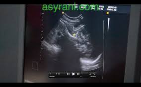 Klinik ini juga mempunyai pakar obstetrik dan ginekologi yang akan membantu anda terutamanya bagi kaum. Pemeriksaan Di Klinik Pakar Wanita Liu Vincent Melaka Asyrani Com