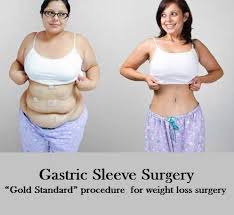 Planning On Reducing Weight Need A Little Help To Get Started Gastricsleevesurgery In Mexico Gastri Sleeve Surgery Gastric Sleeve Surgery Gastric Sleeve