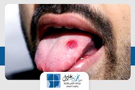 .حيث يتم تخزين كافية البيانات (المحددة في لوحة البيانات والتي يتم تلقيها أثناء تفاعل الخدمة) على خادم بعيد في شكل مشفر لا يمكن إرسالها إلى أي أطراف ثالثة بغض النظر عن. Ø¹Ù…Ù„ÙŠØ© Ø§Ø³ØªØ¦ØµØ§Ù„ Ø³Ø±Ø·Ø§Ù† Ø§Ù„Ù„Ø³Ø§Ù† ÙˆØ§Ù„ÙÙ… Ø§Ù‡Ù…ÙŠØªÙ‡Ø§ ÙˆÙƒÙŠÙÙŠØ© Ø§Ø¬Ø±Ø§Ø¦Ù‡Ø§ Ø¯ÙƒØªÙˆØ± Ù…Ø­Ù…Ø¯ Ø¹Ø§Ø¯Ù„