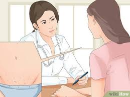 All sexual contacts of the infested person should be examined. 4 Ways To Get Rid Of Pubic Lice Wikihow