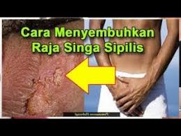 Penyakit ini dapat merusak jantung, otak, kematian janin dan bahkan menyebabkan kematian bagi penderitanya bila terlambat diobati. Pin Di Obat Sipilis