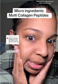 Xyngular Trimstix Collagen Review