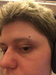 Fresh Eyebrow Piercing Done Yesterday It S Swollen And A Little Bleedy But Doesn T Hurt Much What Can I Expect While Healing About How Long Until The Swelling Subsides Legitpiercing