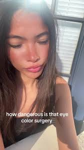 Exploring Adriana Lima's Eye Color and Surgery Risks