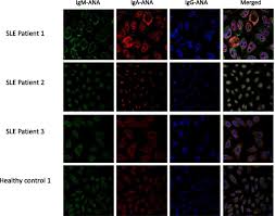 Image result for ANA Staining Pattern