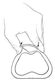 Image result for Patellar Tilt Test