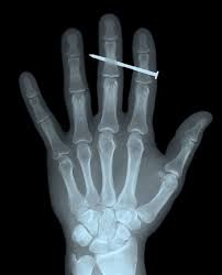 20 Of The World S Most Bizarre X Rays Radiology Humor Radiology X Ray