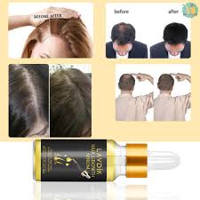 We are learning more about how hair growth is controlled at a cellular level, but scientific evidence on how to speed up hair growth directly is still. Lavdik Hair Growth Serum Hair Loss Treatment Prevention Liquid For Hair Regrowth Thicker Longer Stro Shopee Malaysia