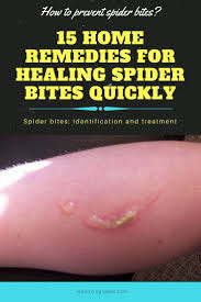 Pin On Health Remedies