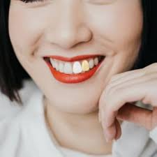 2 peças de tampa de dente único banhada a ouro hip hop dentes simples  grelha dentária superior inferior para homens hip hop dourado, 1X0.8cm,  latão