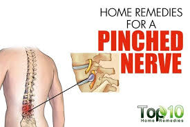 Pin On Sciatica