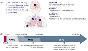 94,666 likes · 5,264 talking about this. Measles Encephalitis Towards New Therapeutics Abstract Europe Pmc