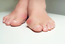 To look and feel your best, you have to eat adequate amounts of the proper foods. 5 Foot Problems That Look Like A Bunion But Aren T Nagy Footcare