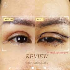 https www facebook com altoneal