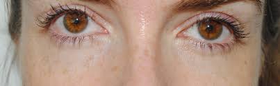 Squueze a dollop of clinique even better eyes dark circle corrector. Clinique Even Better Eye Dark Circle Corrector Review With Before And After Photos Really Ree