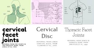 A pulled muscle in the chest can result in mild discomfort or cause severe symptoms. Pain Between Your Shoulder Blades Not A Poking Matter The Motive Physical Therapy Specialists