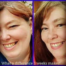 How much weight would you like to lose if you couldn't fail?🤔