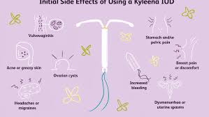 Everything You Need To Know About Kyleena Iud