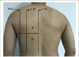 Today its hurting in my left upper chest area and towards… read more. Areas 5 And 6 Denote The Upper Backside And Basal Backside Chest Areas Download Scientific Diagram