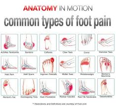 See full list on footankle.com Common Types Of Foot Pain Advance European Medicare Center