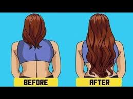 Hormone imbalances and changes can contribute to thinning hair. Hair Loss Best Treatment For Men Women Natural Home Remedies Hair Loss Home Remedies 2020 Youtube